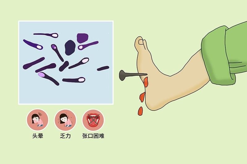 如何預防破傷風感染？（主任醫師三甲如何防治破傷風） 如何預防破傷風感染？（主任醫師三甲如何防治破傷風） 龍魚百科 第8張