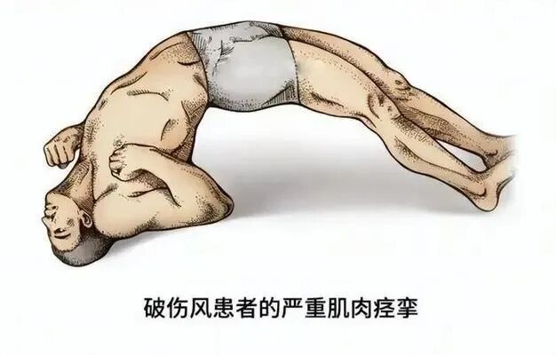 TAT和TIG的區(qū)別是什么？
