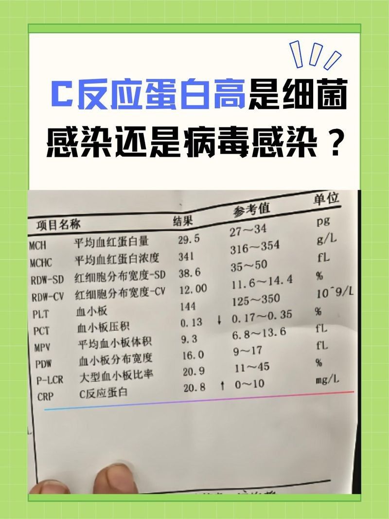 如何區分細菌感染和病毒感染