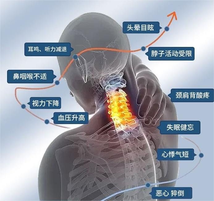 非手術療法中哪種最有效 非手術療法中哪種最有效 龍魚百科 第7張