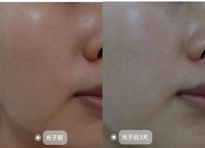 如何調整紅光與白光的比例（攝影中自動白平衡和手動白平衡的區別）