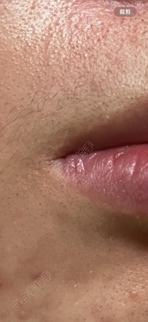 龍魚嘴角有白色肉芽圖片