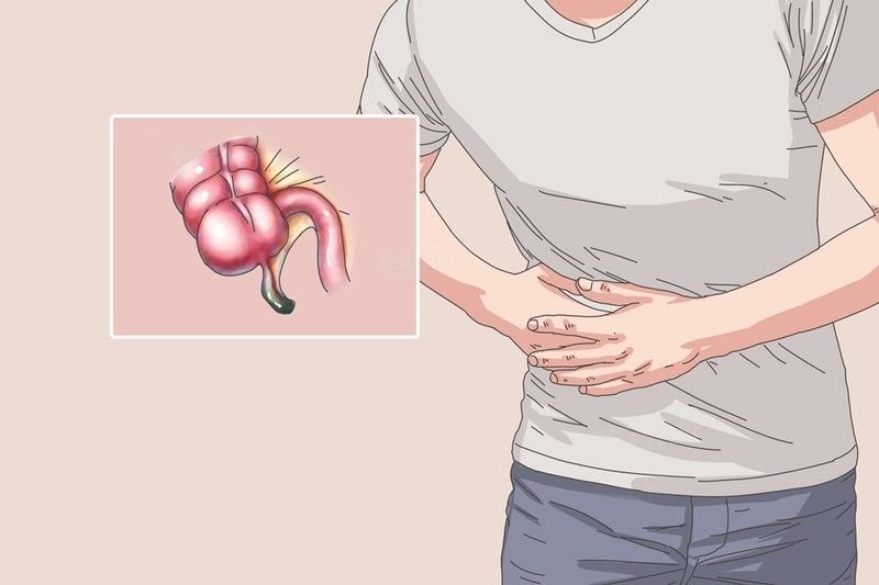 闌尾炎手術后如何預防復發 闌尾炎手術后如何預防復發 龍魚百科 第8張
