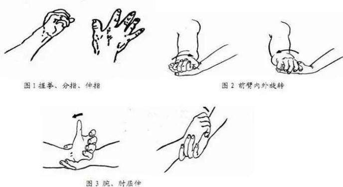 闌尾炎手術后如何預防復發 龍魚百科 第3張 闌尾炎手術后如何預防復發 闌尾炎手術后如何預防復發 龍魚百科 第3張