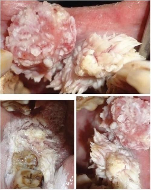 龍魚嘴起肉疙瘩圖解（魚嘴起肉疙瘩圖解）
