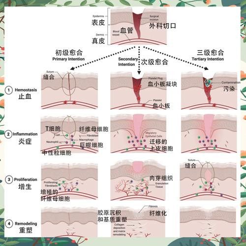 如何促進傷口愈合（傷口怎么樣愈合快）