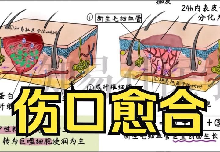 如何促進傷口愈合（傷口怎么樣愈合快）