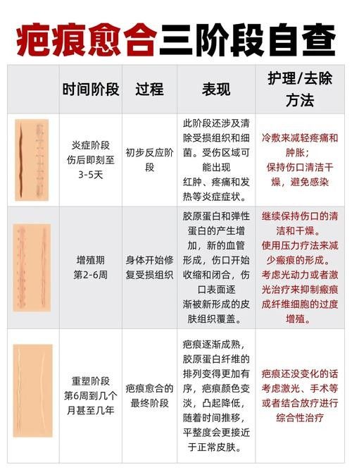 如何促進傷口愈合（傷口怎么樣愈合快）