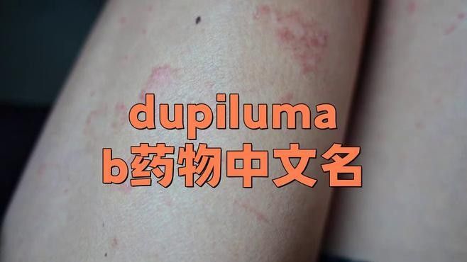速倍妥疾?。ㄟ_必妥（度普利尤單抗注射液）） 速倍妥疾?。ㄟ_必妥（度普利尤單抗注射液）） 觀賞魚百科 第4張