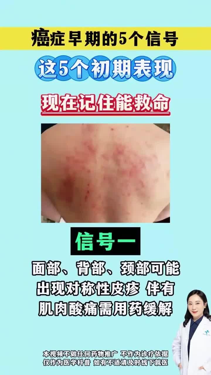 眼斑魚是癌癥早期癥狀（“眼斑魚”是癌癥早期癥狀，醫生提醒：眼睛出現4種變化）