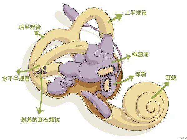 耳石復位法有哪些風險？（汨羅市人民醫院開展眩暈手法復位逃跑的“石頭”） 耳石復位法有哪些風險？（汨羅市人民醫院開展眩暈手法復位逃跑的“石頭”） 龍魚百科 第2張