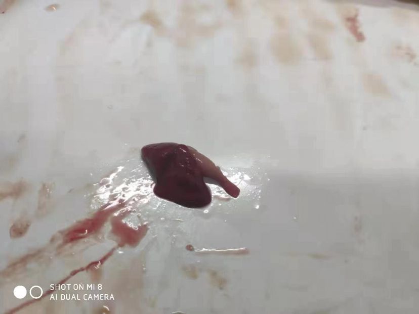 龍魚暴斃解剖全過程，中毒？寄生蟲？腸炎？（導致龍魚暴斃的原因有哪些？） 龍魚暴斃解剖全過程，中毒？寄生蟲？腸炎？（導致龍魚暴斃的原因有哪些？） 觀賞魚百科 第5張