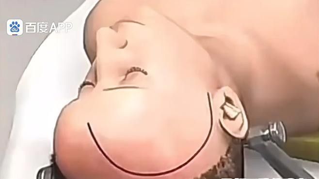 手術成功率高嗎？（|帶你了解開顱手術過程崔醫生講科普）