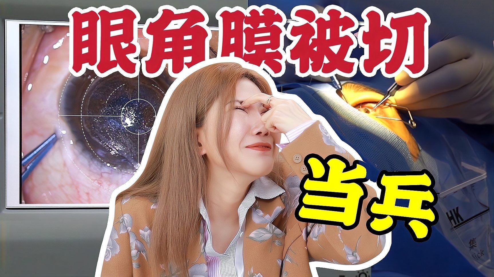 后天性掉眼多久會恢復(fù)？