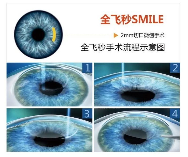 手術矯正風險大嗎？（矯正手術的風險分析）