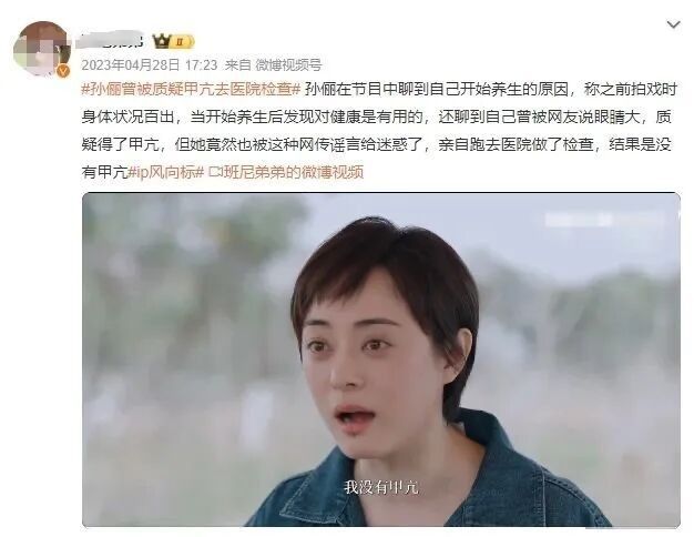 突眼病有哪些癥狀？（三甲甲狀腺突眼患者有什么癥狀）