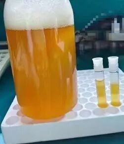 感染性腹水和代謝性腹水的典型病例（感染性腹水與代謝性腹水的區(qū)別）