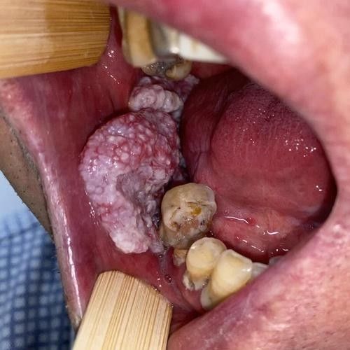 龍魚嘴白色 龍魚嘴白色 觀賞魚百科 第5張