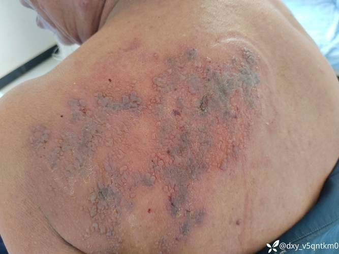 虎魚病癥狀圖片