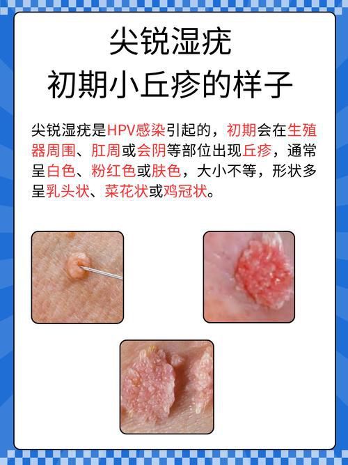 能提供這四種病的圖片嗎？