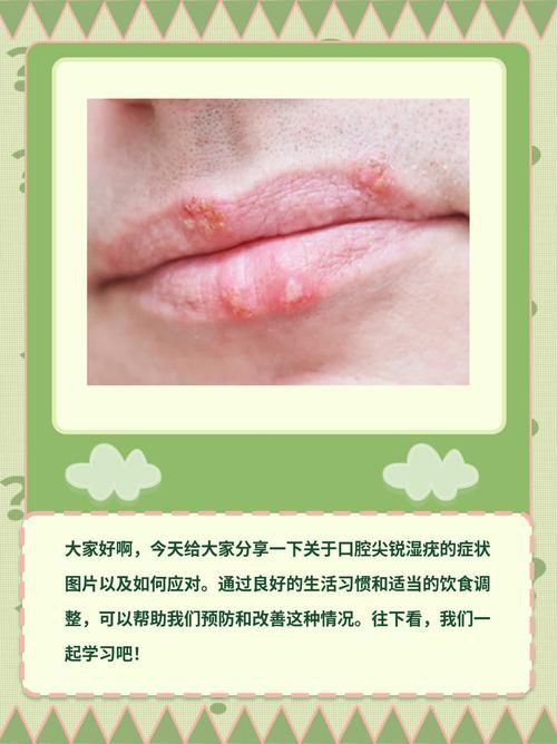 能提供這四種病的圖片嗎？
