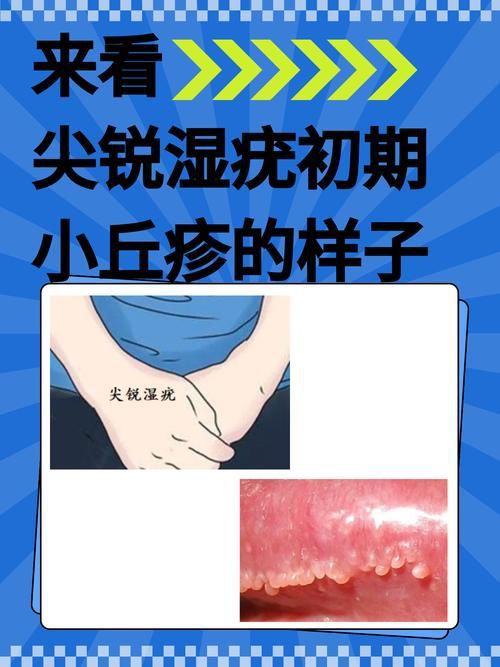 能提供這四種病的圖片嗎？