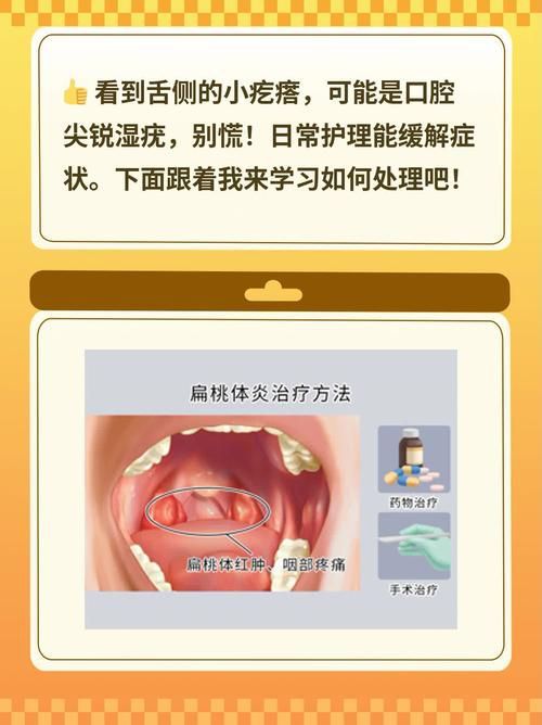 能提供這四種病的圖片嗎？