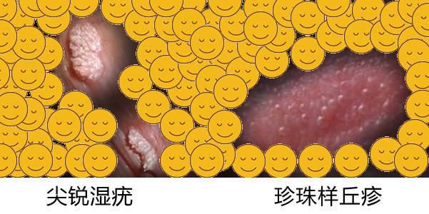 能提供這四種病的圖片嗎？