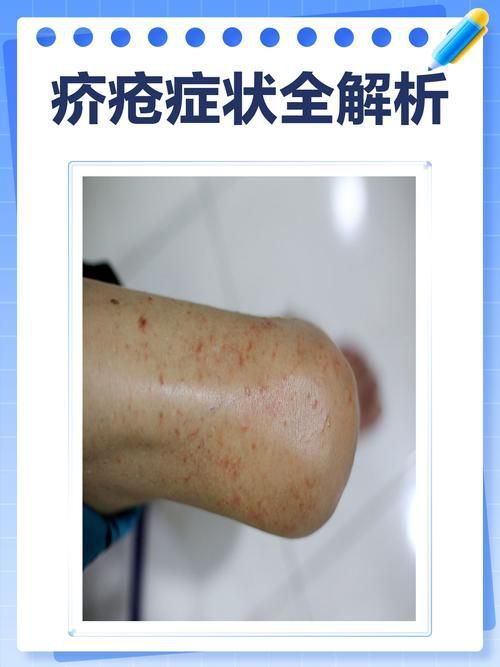 能提供這四種病的圖片嗎？
