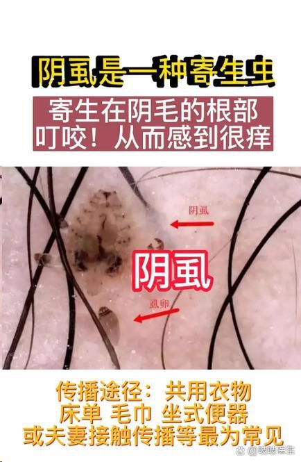 能提供這四種病的圖片嗎？