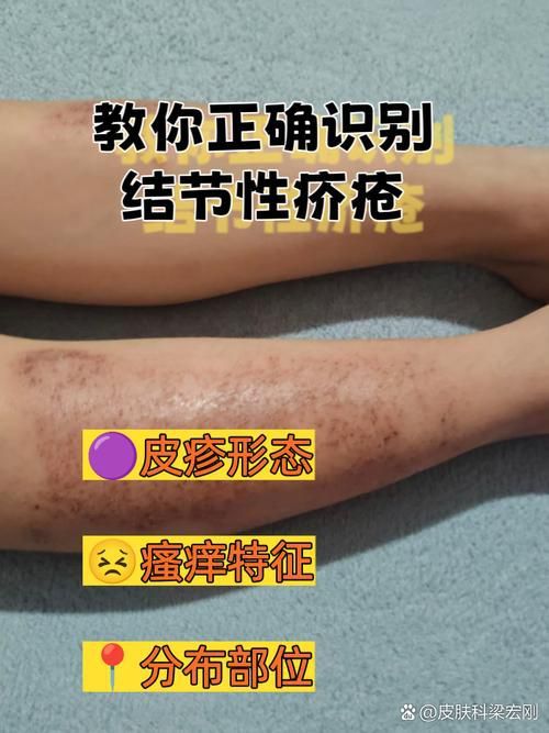 能提供這四種病的圖片嗎？