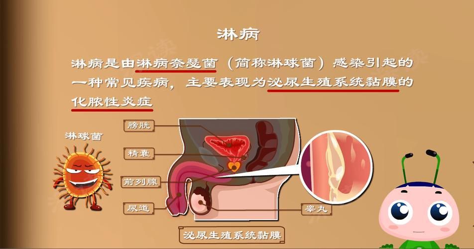 能提供這四種病的圖片嗎？