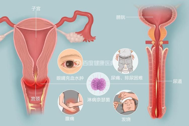 能提供這四種病的圖片嗎？