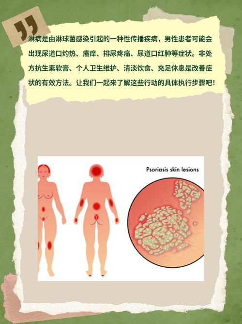 能提供這四種病的圖片嗎？
