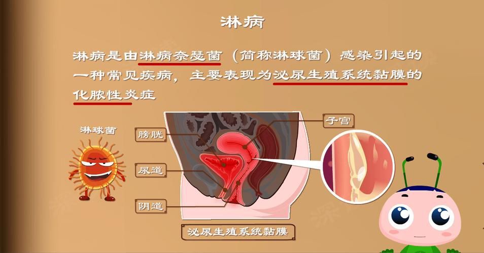能提供這四種病的圖片嗎？