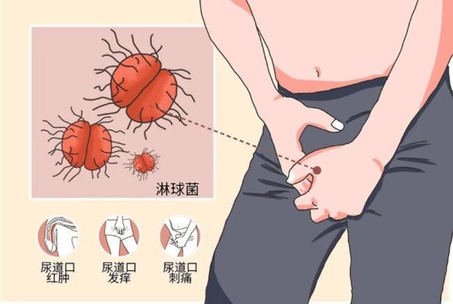 能提供這四種病的圖片嗎？