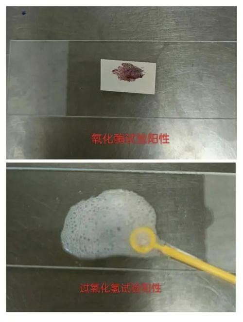 能提供這四種病的圖片嗎？