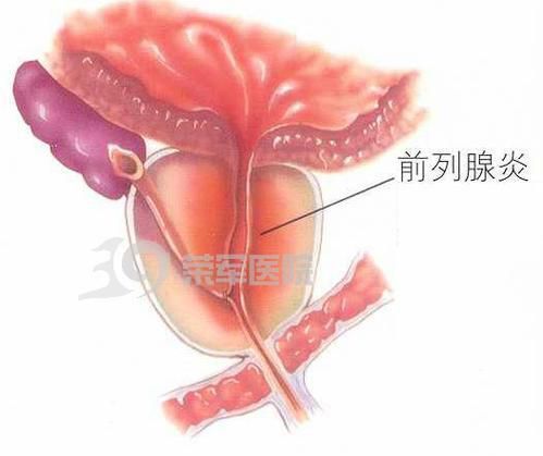 能提供這四種病的圖片嗎？