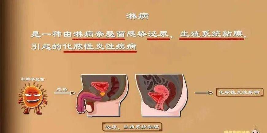 能提供這四種病的圖片嗎？