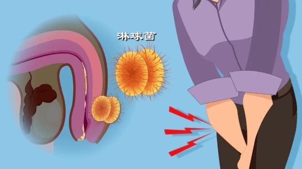 能提供這四種病的圖片嗎？