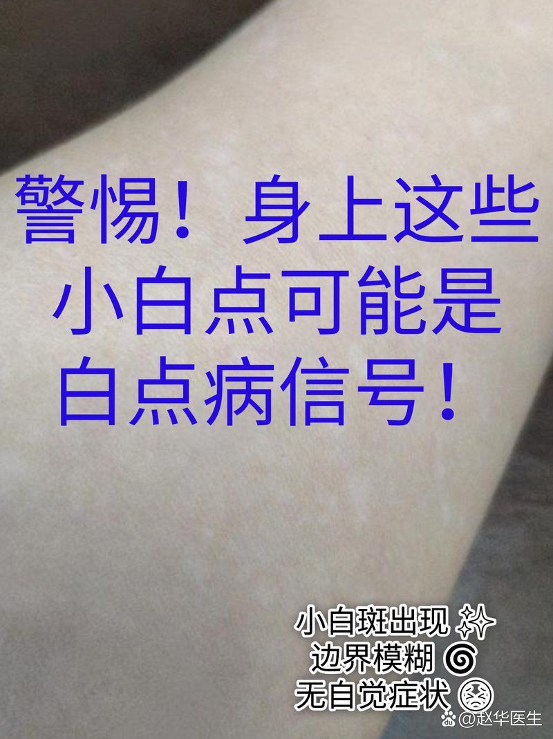 如何判斷龍魚(yú)是否患有水霉病或白點(diǎn)病？