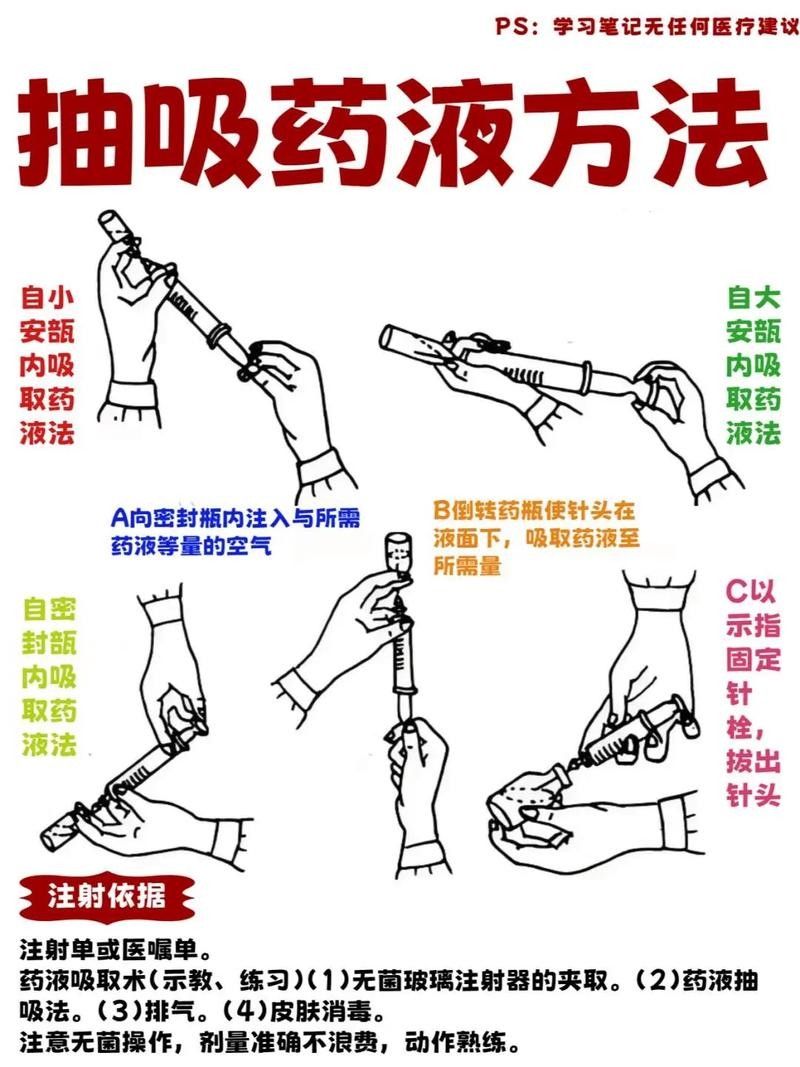 龍魚腹水抽液需要多大針，龍魚腹水抽液需要多大的針，如何抽除龍魚的腹水