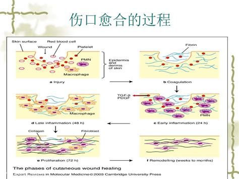 被龍魚(yú)咬爛的傷口會(huì)自愈嗎？，被龍魚(yú)咬爛的傷口是否能自愈