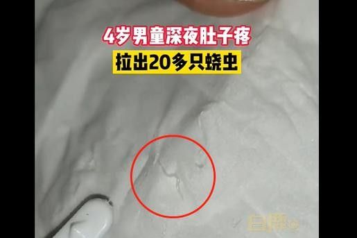 菠蘿魚白點(diǎn)病如何預(yù)防？（菠蘿魚患上白點(diǎn)病，除了它們）