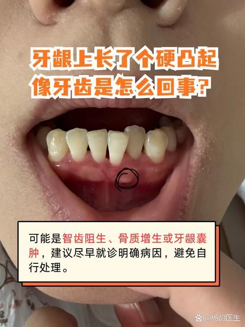 如何區分龍魚嘴上的肉疙瘩是病還是珠星？（龍魚嘴上的肉疙瘩是病嘴上的肉疙瘩是病嘴唇或吻端出現的）