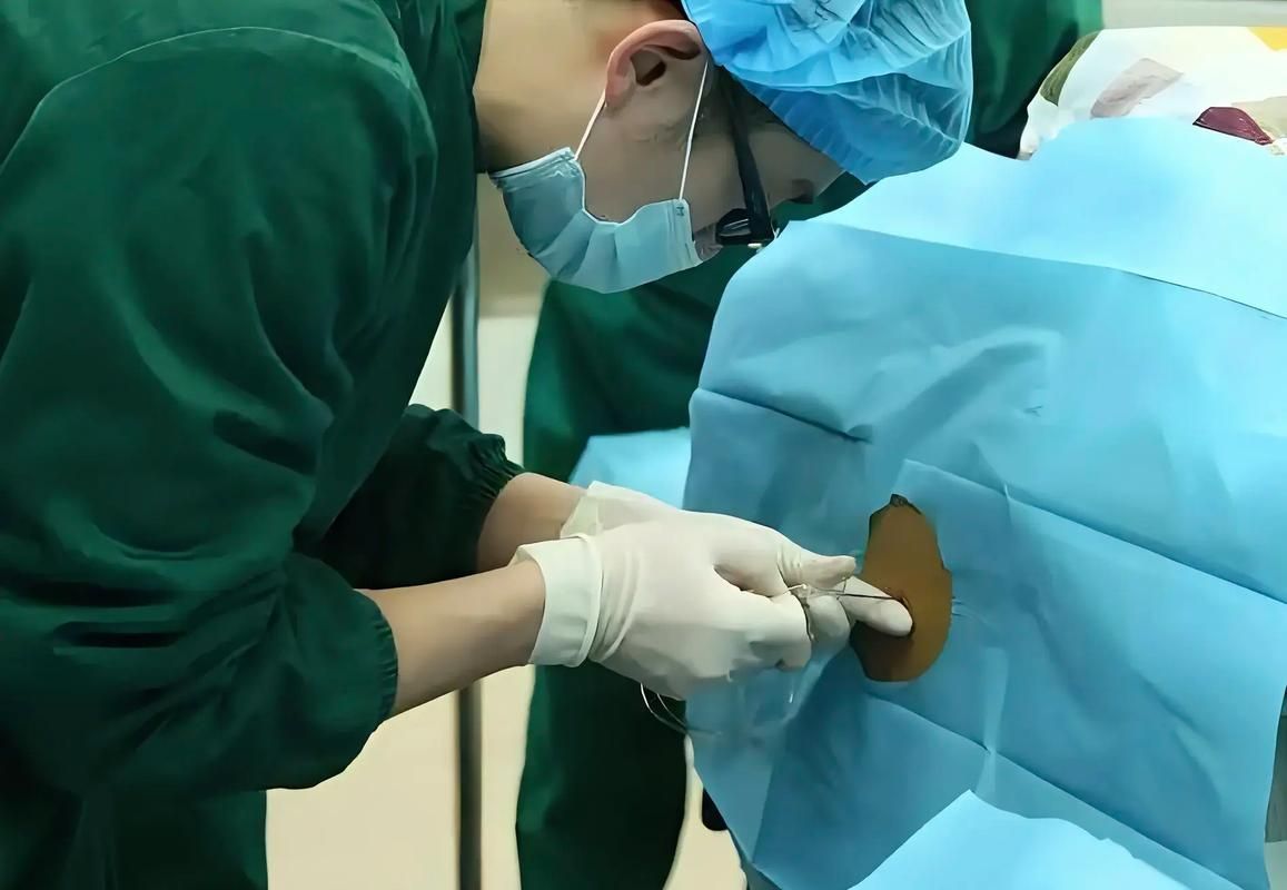 手術治療龍魚胡須疙瘩風險大嗎？