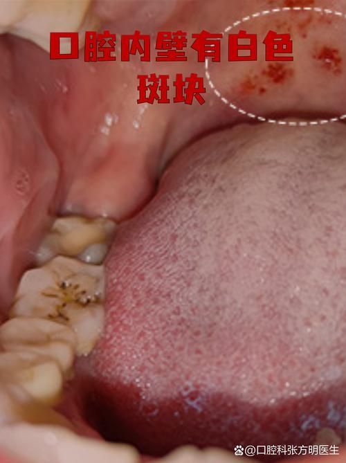 如何預(yù)防龍魚嘴上長肉球或癌？（mcp學(xué)術(shù)文章搜索服務(wù)（server_id=2） 如何預(yù)防龍魚嘴上長肉球或癌？（mcp學(xué)術(shù)文章搜索服務(wù)（server_id=2） 龍魚百科 第2張