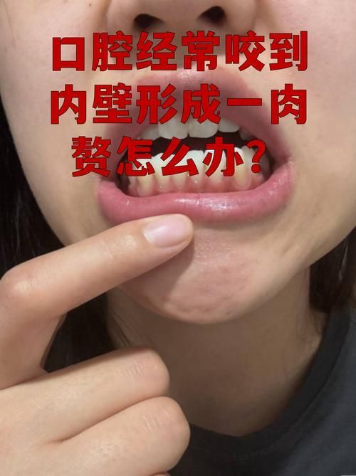 如何預(yù)防龍魚嘴上長肉球或癌？（mcp學(xué)術(shù)文章搜索服務(wù)（server_id=2） 如何預(yù)防龍魚嘴上長肉球或癌？（mcp學(xué)術(shù)文章搜索服務(wù)（server_id=2） 龍魚百科 第4張