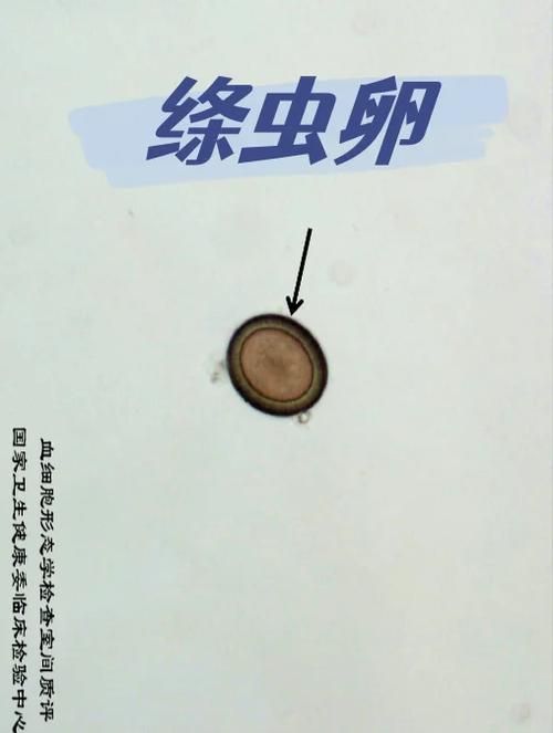 龍魚感染內寄后還能活多久？（arxiv論文助手（arxiv論文助手,龍魚感染內寄后能否存活）