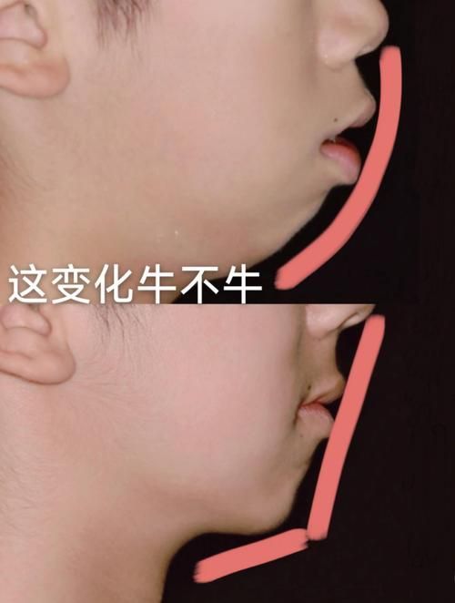 哪種方法矯正龍魚口合不攏最有效？（arxiv論文助手（arxiv論文助手）哪種方法矯正最有效）